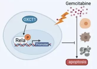Schematic showing OXCT1 upregulation activating NF-κB (p-IKKβ/IκBα/P65), reducing apoptosis and promoting PDAC resistance to gemcitabine; NF-κB inhibitor reverses resistance.